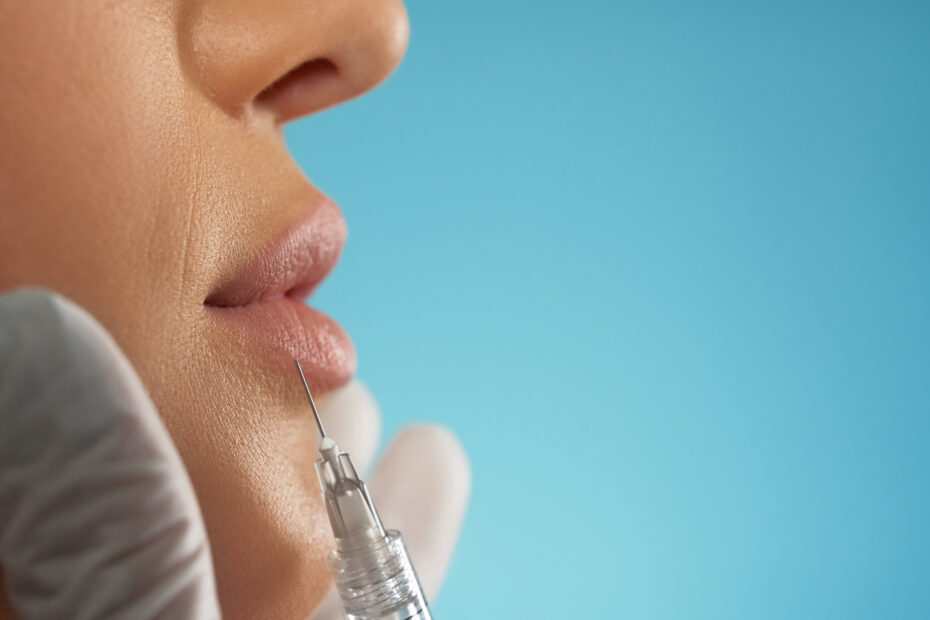 cosmetic botox injection in lips.